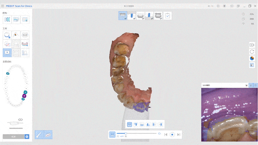 Acquisition de données