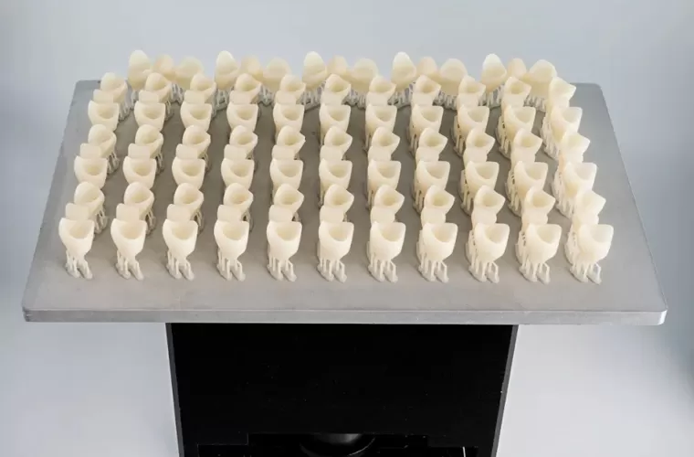 Couronne et pont temporaires